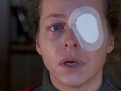 “Noté el impacto en la cara. Mucho dolor. Y dije: no tengo ojo”