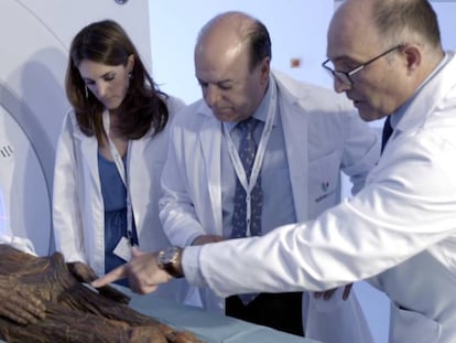 Médicos del Hospital QuirónSalud Madrid realizan un TAC a una de las cuatro momias del Museo Arqueológico Nacional.