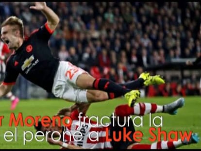 Luke Shaw se fractura la tibia y el peroné.