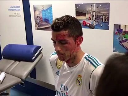 Así curaron la herida de Cristiano tras el partido contra el Deportivo