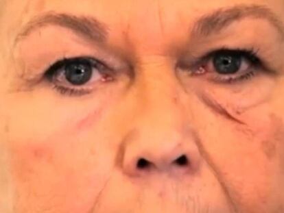 Un equipo científico crea un gel que tapa arrugas y quemaduras