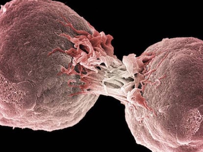 El tractament contra el càncer que substituirà la quimioteràpia
