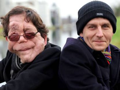 El actor británico Adam Pearson (izquierda), con su hermano gemelo.