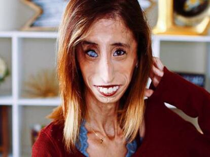 Lizzie Velasquez en una fotografía del pasado mes.
