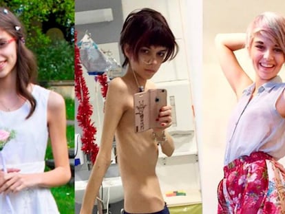 El apoyo en redes sociales ha ayudado a Connie Inglis a superar la anorexia.