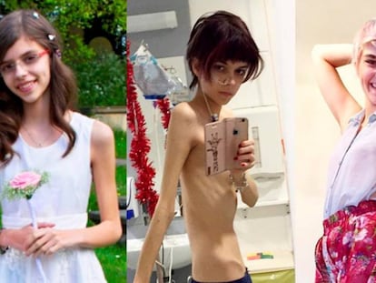 El apoyo en redes sociales ha ayudado a Connie Inglis a superar la anorexia.