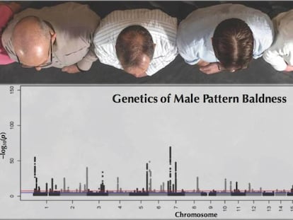 Patrones genéticos de la calvicie en los hombres, según el estudio.