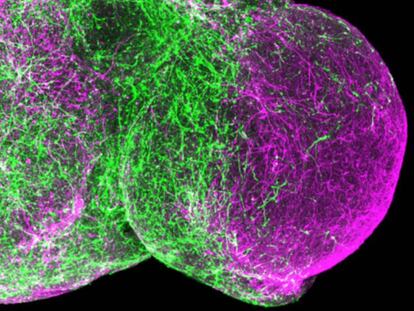 Dos esferoides humanos ensamblados, el ventral a la izquierda, el dorsal a la derecha. Las neuronas inhibidoras (verde) están migrando a la zona dorsal y formando circuitos allí.