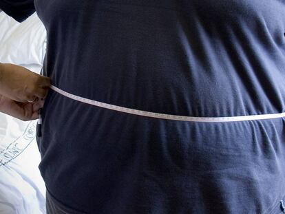 Un médico mide la cintura de una persona obesa.