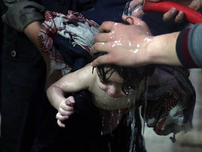 Un niño es tratado en un hospital de Duma tras el supuesto ataque químico.