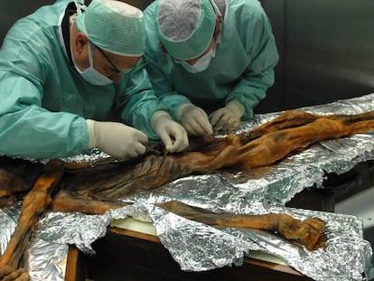 Imagen de la recogida de muestras del estómago de Ötzi en Bolzano.