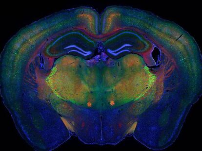 El cerebro de un ratón con los diferentes tipos celulares destacados. En vídeo, así es la primera base de datos abierta de células vivas del cerebro humano.