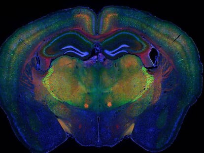 El cerebro de un ratón con los diferentes tipos celulares destacados. En vídeo, así es la primera base de datos abierta de células vivas del cerebro humano.