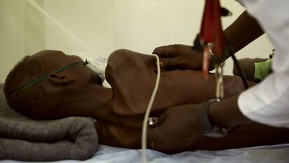 En la foto William Akol es un hombre de 46 años proveniente de Payindwei, un pueblo a una hora en coche de la ciudad sursudanesa de Malakal. Sufre tuberculosis pulmonar y ha estado en tratamiento dos veces en los dos últimos años, pero en ambos casos tuvo que interrumpirlo antes de tiempo. VÍDEO: Testimonio de John, paciente de tuberculosis de Sudán.