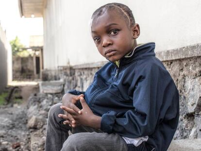 Foto: Davide Kasereka, de cinco años, recibió un disparo en el cráneo en abril de 2018 a manos de un agente de policía ebrio en la ciudad de Goma, capital de la provincia de Kivu de Norte, en el noreste de la República Democrática del Congo (RDC). Vídeo: El infierno más allá de la guerra en Goma (RDC).