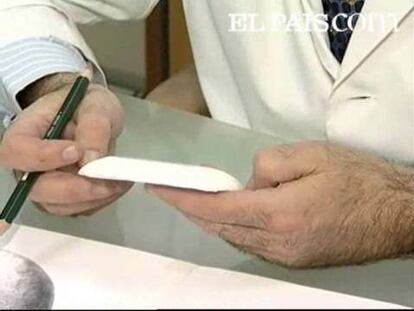De momento se han operado 19 personas y tiene un coste cercano a los 10.000 euros