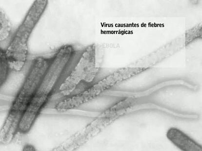 Ébola, lo fundamental