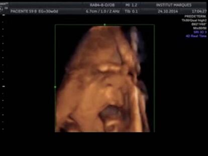 Música a la vagina per estimular el fetus durant l’embaràs