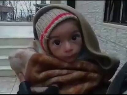 Imagen de una niña siria desnutrida.