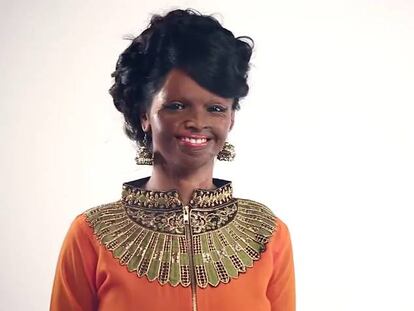 Una joven india, víctima del ácido y modelo