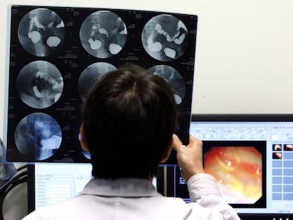 Trasplantes chinos con características españolas