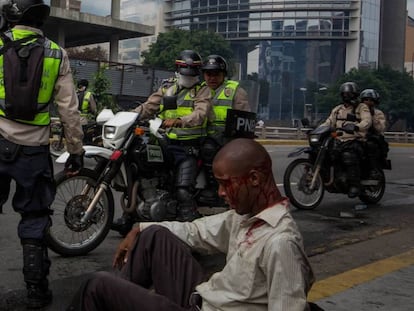 Un hombre herido junto a miembros de la Guardia Nacional Bolivariana.