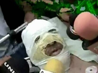 Unos encapuchados prenden fuego a un periodista crítico en Bolivia