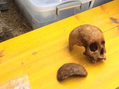 La osteoarqueóloga Lourdes Herrasti, el domingo en Gaztelu, revisando los últimos hallazgos de la fosa.