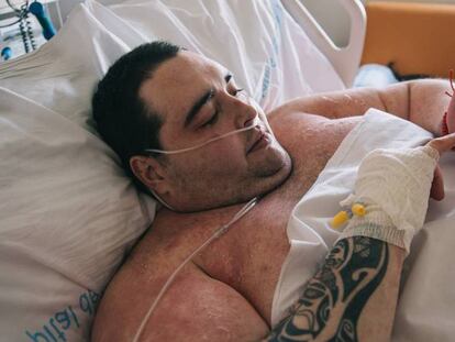 Teófilo Rodríguez, Teo, el joven de Turís de 385 kilos que esta ingresado en el Hospital de Manises, Valencia.
