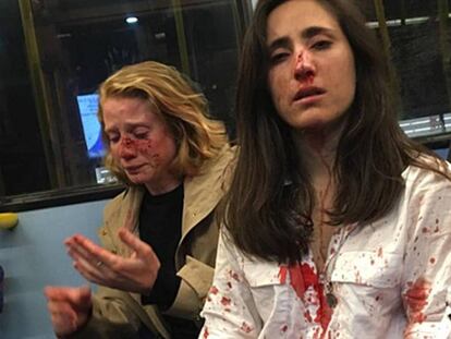 Melania Geymonat (d.) y su novia, tras la agresión que sufrieron en un autobús de Londres el 30 de mayo. En vídeo, la pareja narra cómo fue la agresión.