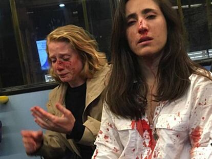 Melania Geymonat (derecha) y su novia, Chris, tras la agresión que sufrieron en un autobús de Londres el 30 de mayo. En vídeo, la pareja narra cómo fue la agresión.