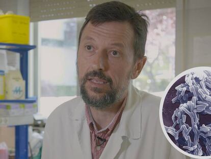 El especialista en microbiología, Julio García Rodríguez, atiende las dudas sobre listeriosis.