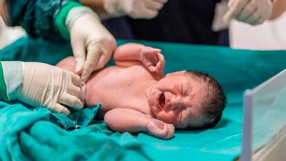 Un doctor corta el cordón umbilical a un recién nacido.