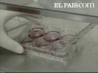 Este procedimiento no presenta, a priori, dilemas morales.