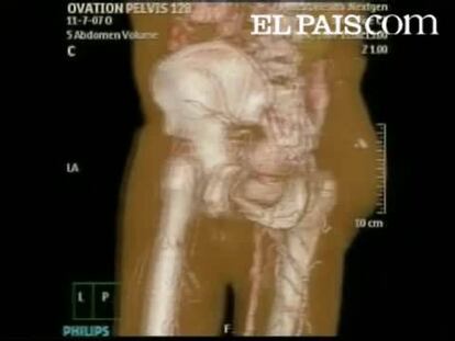 Ofrece de forma casi instantánea imágenes de cualquier órgano en tres dimensiones