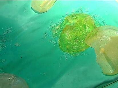 Más de 5.000 mujeres sientan ante el juez al fabricante de las mamas PIP