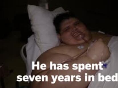 In Mexico, world’s heaviest man operated on to reduce his stomach