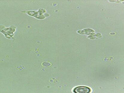 Amebas Naegleria fowleri o "come cerebro" vistas con un microscopio.