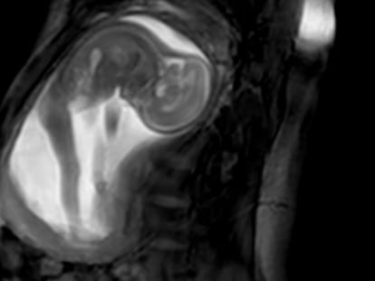 Los bebés no patean para comunicarse: están haciendo ejercicio