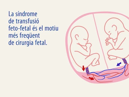 Sant Joan de Déu crea un GPS per millorar la cirurgia fetal