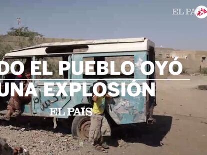 Así es la vida en un hospital de campaña en Yemen (3): Todo el pueblo oyó una explosión
