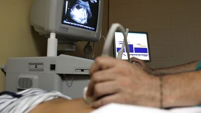 El Consejo de Minsitros aprobó el viernes el proyecto de la nueva ley del aborto.