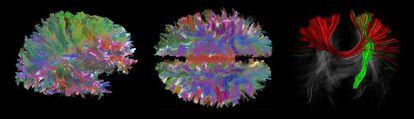 Mapa cerebral en 3D de MintLabs.