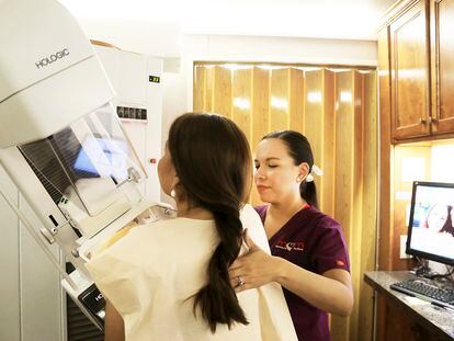 Una mujer se hacía una mamografía en una unidad móvil de radiología en Brownsville (Texas), en septiembre de 2017.