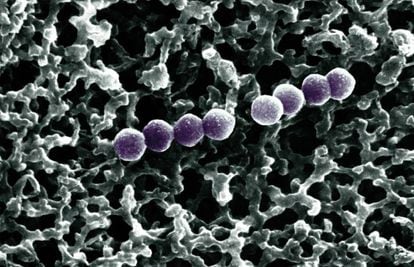 Las bacterias de la especie 'Streptococcus pneumoniae' pueden provocar neumonías letales.