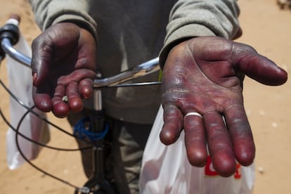 No solo la postura de trabajo durante la recogida de la fresa es dura; las manos se llevan la peor parte. No les dejan trabajar con guantes porque podrían dañar el fruto. Estas son las manos de un jornalero después de seis horas de faena. El uso de pesticidas e insecticidas, junto a los picores que crean las hojas de esta frutilla, provocan picores e irritación en las manos de quien las recoge. Si a ello se suma la continuidad, sin tiempo para que las heridas curen y la falta de agua corriente, al final de la temporada la piel queda oculta bajo un gran callo provocado por estas continuas irritaciones.
