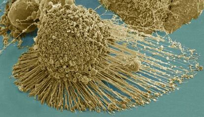 Imagen de célula cancerígena obtenida por microscopio electrónico.