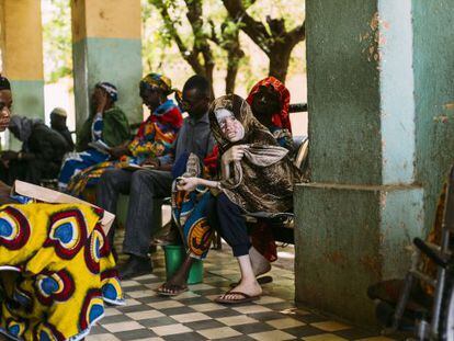 Rabiatou Traor&eacute;, de 15 a&ntilde;os, fotografiada el 26 de junio en el hospital de Bamako. Padece un c&aacute;ncer de piel en la cabeza. 