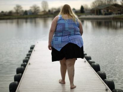 Un 30% de los pacientes que se operan de obesidad m&oacute;rbida vuelve a engordar