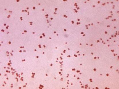 Imagen microsc&oacute;pica de bacterias de gonococo.